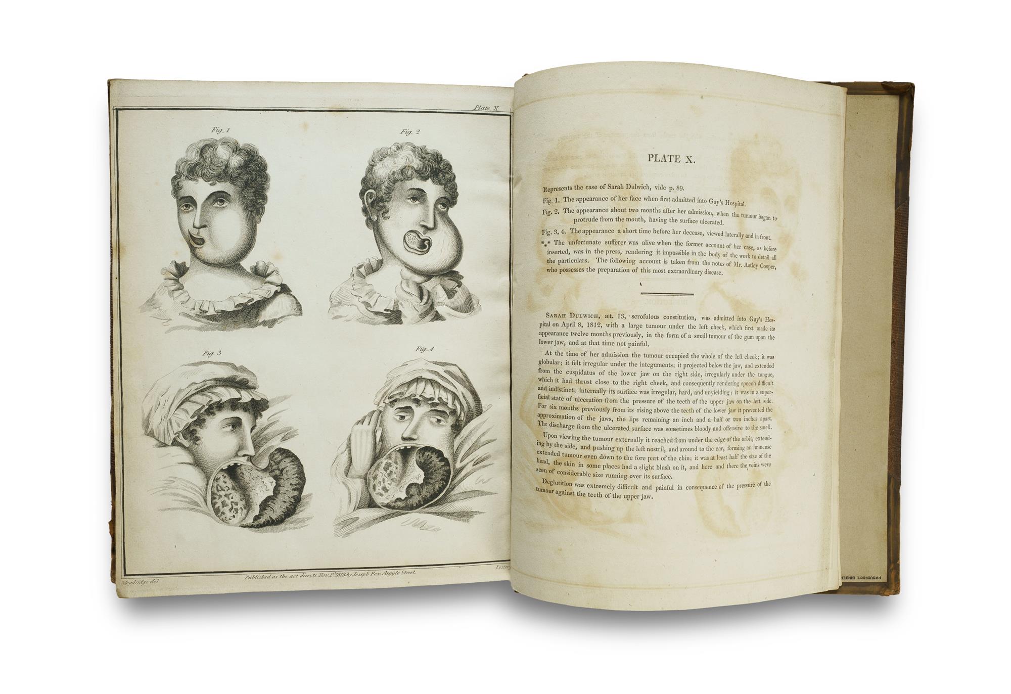 Three Volumes on the History of Teeth: Charles Allen (1687 Reprint) and Jos